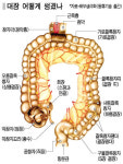 대장암 10명 중 8명 잘못된 식습관 때문