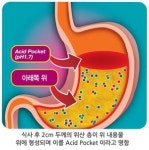 가슴 쓰리고 배도 아플땐…