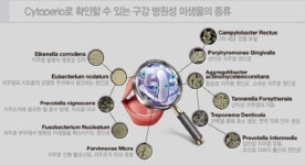경기도 거주 임산부, 방사능 걱정 없이 치주질환검사 무상 실시…전국 최초