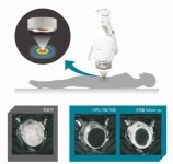국내 첫 하이푸(HIFU) 치료기 개발 성공, 유럽시장 노린다