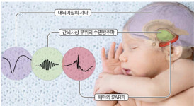 [Science] 수면 중 뇌파조절로 기억력 2배 높인다