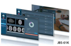 AI가 폐결절 진단·뇌경색 유형 분류
