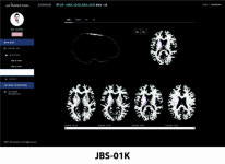 JLK인스펙션, 뇌졸중 및 전립선암 메디컬 솔루션 CE 의료기기 인증