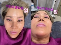 강원래♥ 김송, 피부관리숍에서 각도의 중요성...못났다