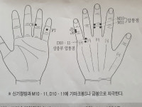 서금요법, 코로나19 백신접종 전후 긴장완화·이상반응 해소에 도움