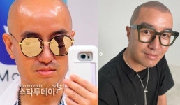 홍석천도 구준엽 이어 ‘두피문신’…어떻게 할까