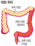 당신의 뱃살이 노리는 장기 ‘대장’… ‘젊은 대장암’ 발병률 1위 한국