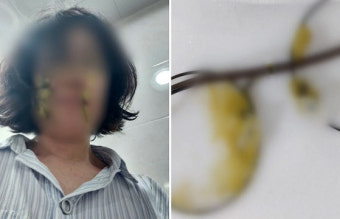얼굴에 똥싸대기?…어린이집 교사에 ‘똥기저귀’ 던진 학부모의 최후