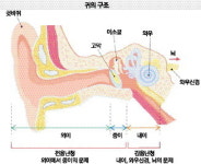 보청기로 안되면 …인공와우 이식이 희망