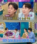 붐, 성형 고백 “최근 눈밑지방재배치, 코 재수술은 NO” (‘라스’)