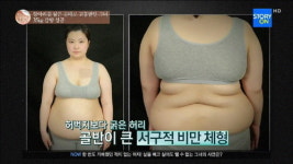 렛미인5 '이세희' 102kg 초고도비만에서 탈출하다