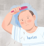 [건강100세]대머리 싫어 카이사르도 두려워한 탈모