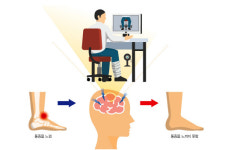 보는 것 만으로 통증 완화 기술 개발