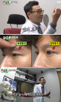 김종국 형, 성형외과 의사 김종명은 누구?