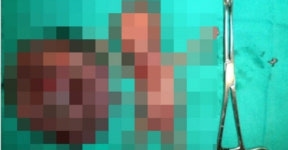 워마드, 수원 목욕탕 남탕에 몰카 설치···다음은 서울 신림 충격