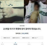 성민이 사건 원장 부부, 근황 봤더니···아직도 버젓이 어린이집 운영?