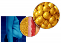 수백억 가치 지닌 폐지방·폐치아…폐기물 족쇄에 돈 내면서 버린다