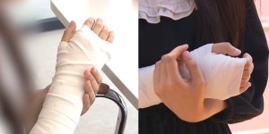 男학생 폭행에 팔 깁스한 교사에게 자필로 다시 고발하라 교육청 황당 요구