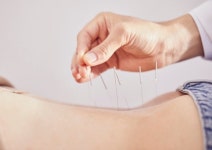 30대 女 한의원서 봉침 맞고 사망했는데 …한의사 감형 이유 보니