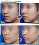 100세 수명시대에도 동안 유지하려면