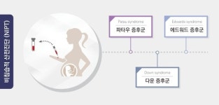 시선바이오머티리얼스, NIPT 진단키트 개발로 산자부 사업화연계기술개발사업 주관기관 선정
