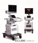 알피니언 메디칼시스템, 초음파 진단기 이큐브 플래티넘 출시