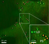 몸속 흡수된 미세플라스틱을 찾아냈다
