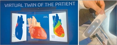 보청기 안경, 모의수술 돕는 3D 심장… 헬스테크의 진화[CES 2024 AI·디지털 헬스케어의 향연]