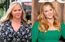 “얼굴이 너무 이상해" 악플 덕분에 ‘이 병’ 알았다...美 영화배우의 사연 [헬스톡]