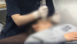 한의원 피부 시술? 부작용 감당 가능하겠냐..한의원 별점 테러범 잡고 보니 현직 의사