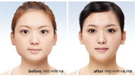 사극 속 여주인공이 예뻐 보이는 이유 V라인에 있었네