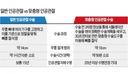 [Health] 3D 프린터로 만든 맞춤형 인공관절 시대 열렸다