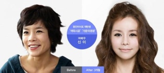 신이, 양악수술 전 외모 어땠길래?…비교해보니 이럴 수가!
