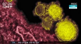 소두증 지카바이러스, 방역당국 예방 태세 강화..여행 자제-모기기피제 사용