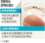 첨단 의료기기로 진화하는 콘택트렌즈