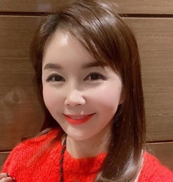 장영란 해명 '얼굴 다 뜯어고쳤다' 댓글에 