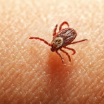 환자 살리려 심폐소생술 하던 의료진 살인 진드기병 감염