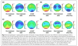 아이메디신, 브레인매핑기술 재활의학 분야로 확대 추진