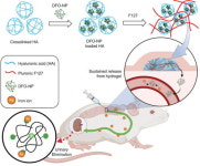 김문석 아주대학교 교수, 미국 하버드대와 철분과잉증 환자 치료방법 개발