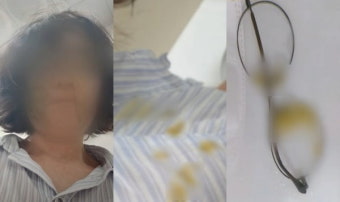 '똥 기저귀 던진 학부모'…어린이집 교사 보호 청원 5만명 동의