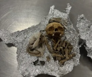 사람 두개골이 왜 나와 경악…공항 세관서 딱 걸렸다