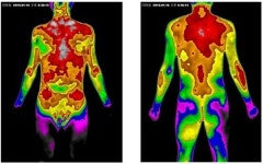 대전교통사고한의원 “교통사고치료는 불부항으로 어혈까지 치료해야”