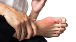 통풍 환자 10명 중 7명 “술 때문에 통증악화”