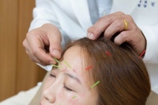 피부 탄력 회복도 이제 ‘한방성형’이 대세… 부작용 없는 ‘동안침’ 효과 주목