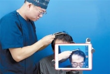 노블라인 백현욱 원장, 국제모발이식학회에서 LPV발표