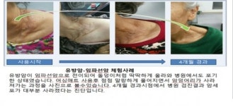 만병통치 침구로 속여 판 불법다단계 조직 7명 입건