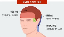 [김태열 기자의 생생건강] 갑작스럽게 깨질듯이 아픈 두통, 아픈 부위별로 ‘질환’도 달라