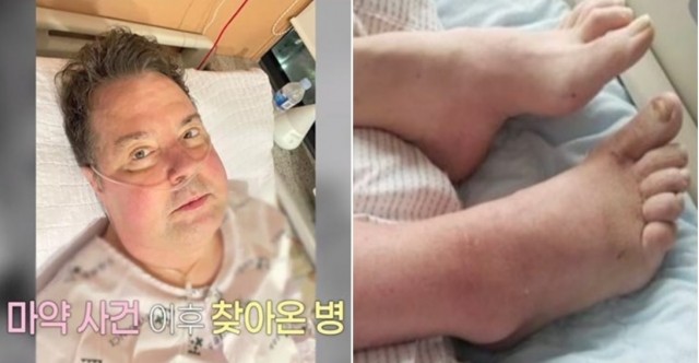 로버트 할리, 희귀암 투병 후 회복중...고백에 많은 사람들 감동