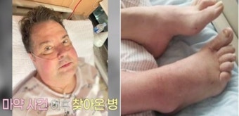 로버트 할리, 희귀암 투병 후 회복중...고백에 많은 사람들 감동