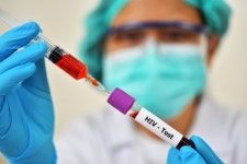 에이즈 HIV 감염 동성 간 성 접촉 1위...함께 쓴 마약주사 감염도 급증